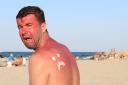A dermatologist has warned that using Vaseline to heal sunburn can make the pain a lot worse.
